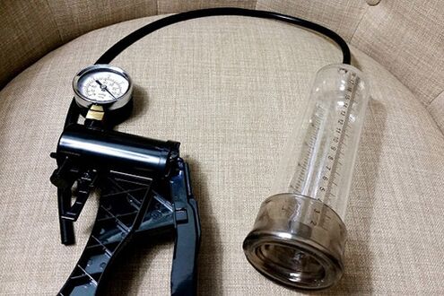 Гейлермен жыныстық қатынас